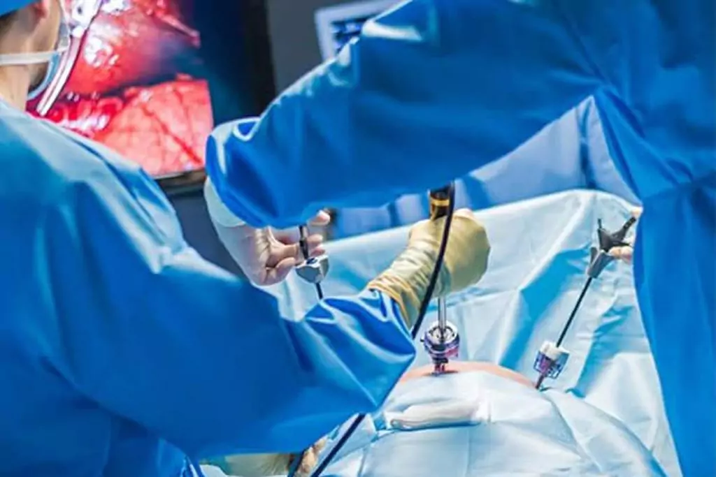 Laparoscopic surgeries